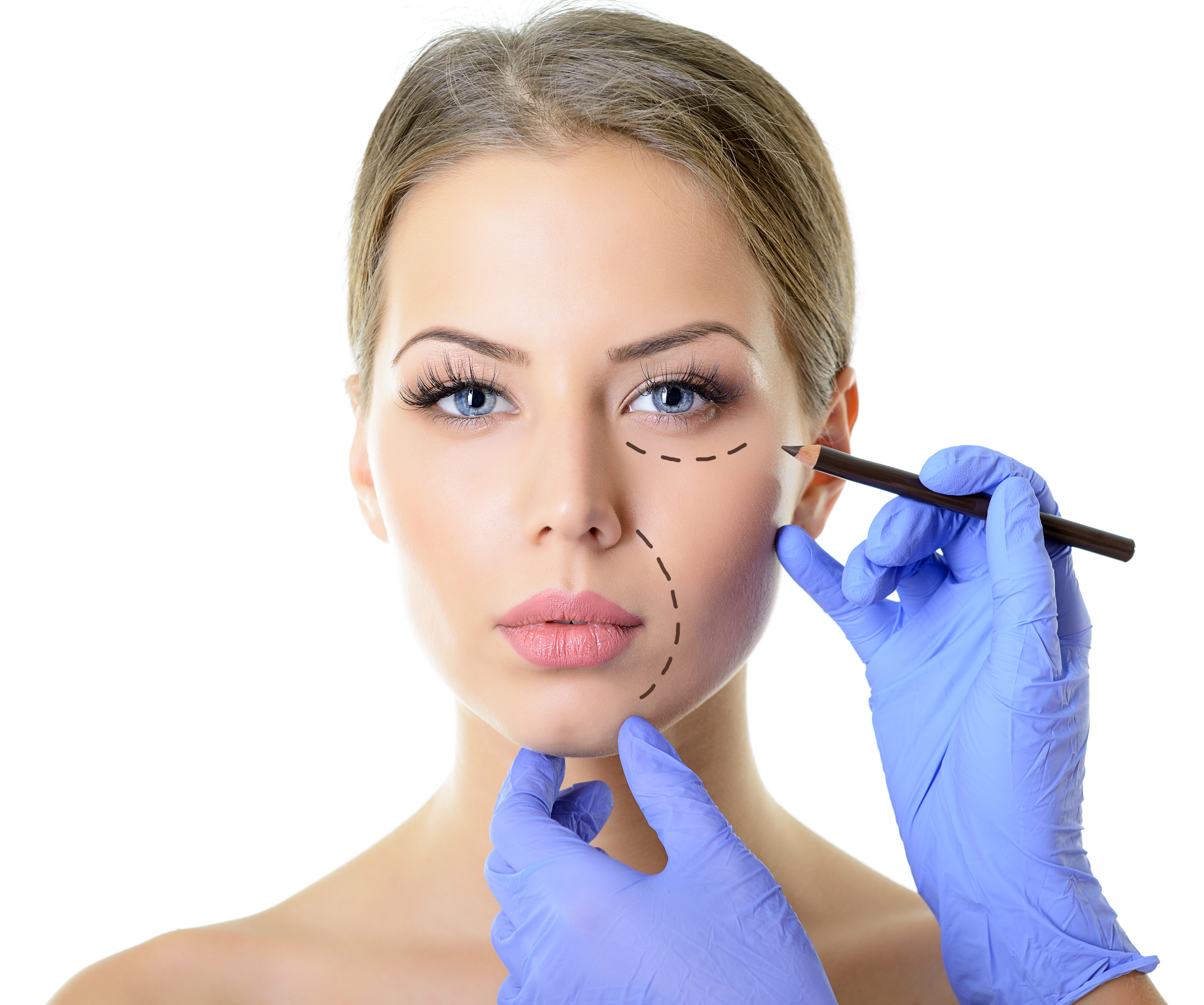 Facial Cosmetic Surgery