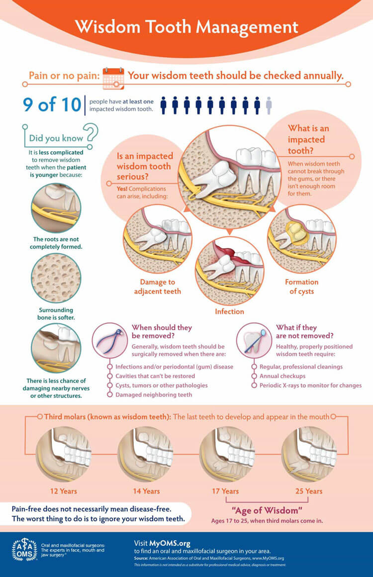 Wisdom Teeth Management Infographic